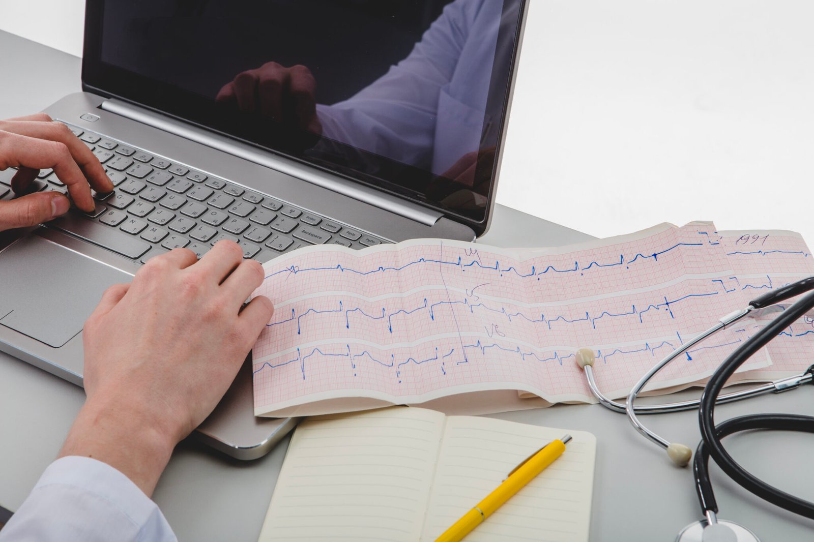 Electrocardiograma